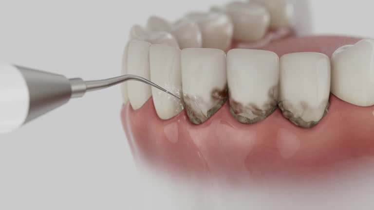 Reliable Tooth Extraction contractor in Lakeview, MI by Smile Center Dentistry